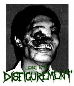 Living With Disfigurement : Living with Disfigurement